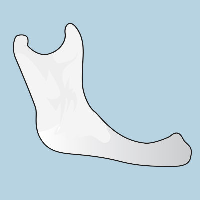 Wurzelkanalaufbereitung